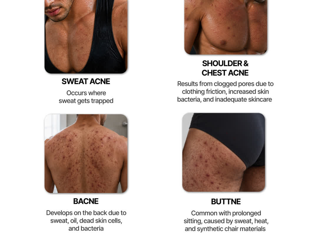 Multivitamin Bacne Clear Body Wash, feature 3 of 7