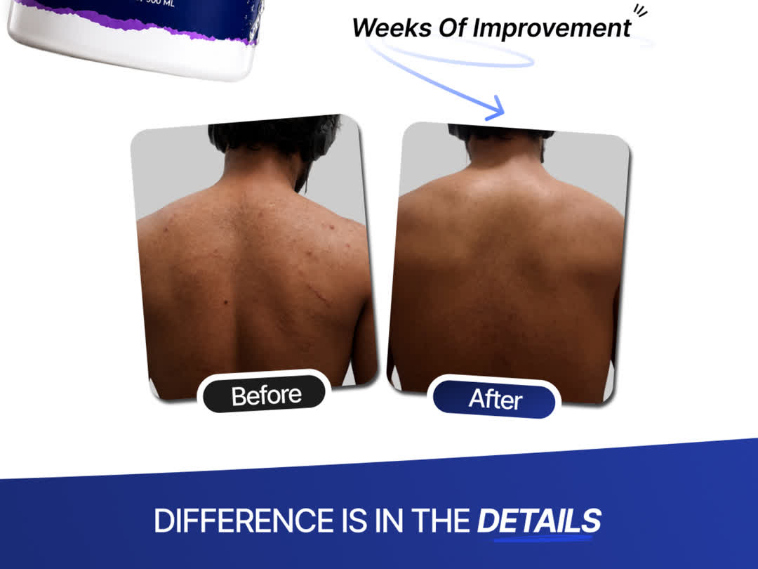 Multivitamin Bacne Clear Body Wash, feature 5 of 7