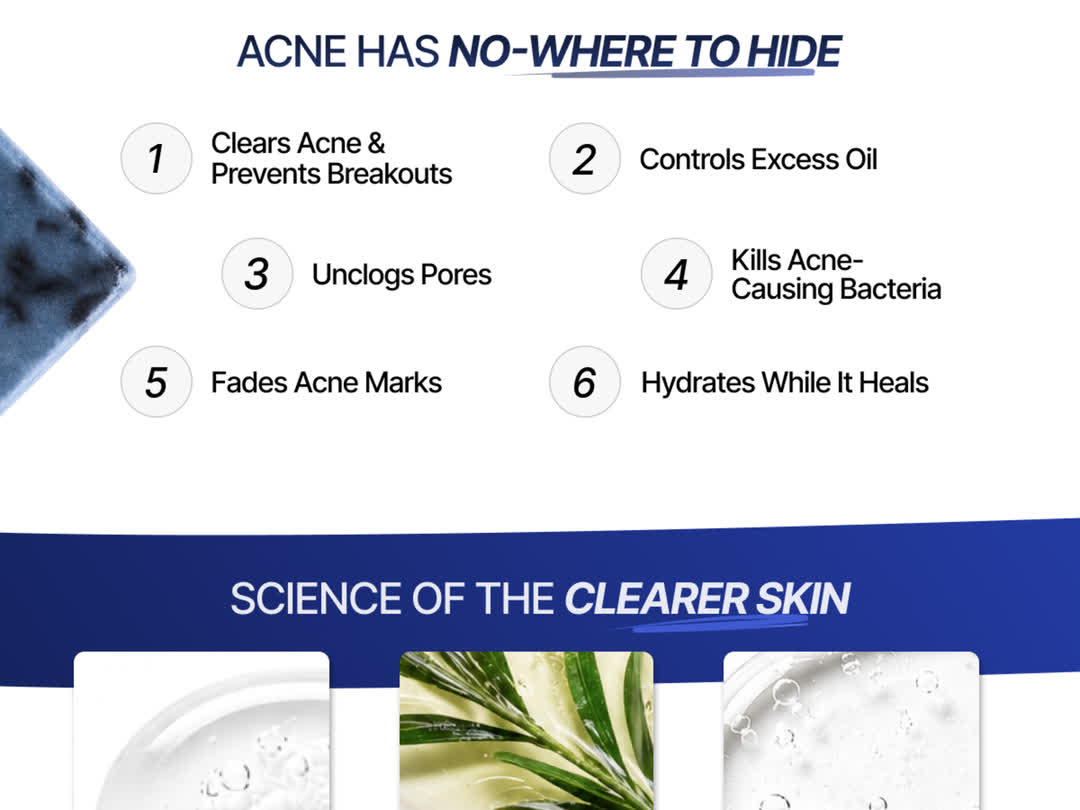 Anti Acne Soap with 2% Salicylic Acid | 75g Pack of 2, feature 2 of 6
